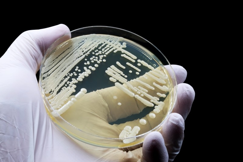 Candida Auris
